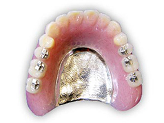 金属義歯（うすい金属の入れ歯）